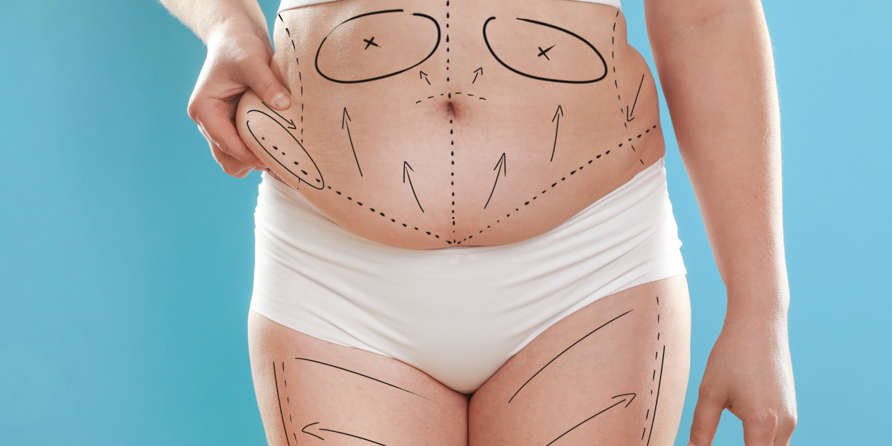 Fat dissolving injections treatment for double chin at London Aesthetics U.K.