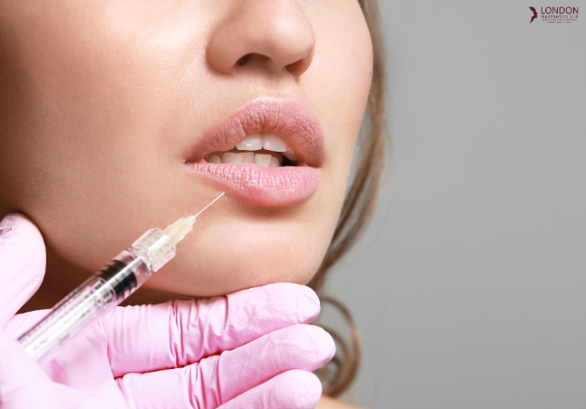 Natural lip fillers results at London Aesthetics U.K. Pakistan