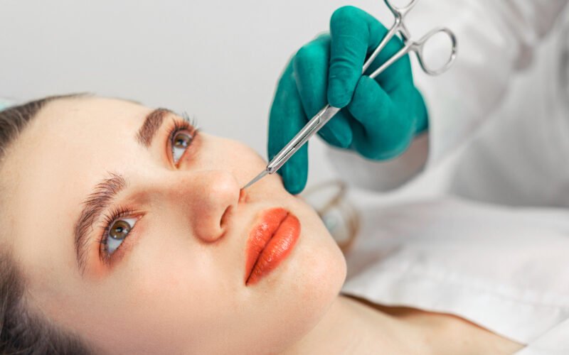 Rhinoplasty The Modern Nose Job for a Perfect Profile